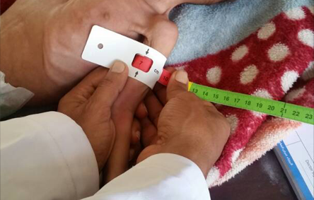 Doctor measures arm of malnourished child